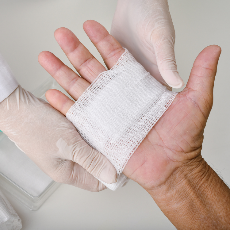 Clinician providing wound care related to venous & arterial ulcers