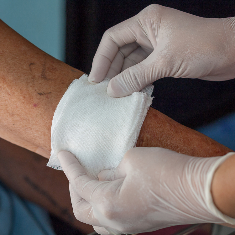 Clinician applying a clean dressing to a patient's wound