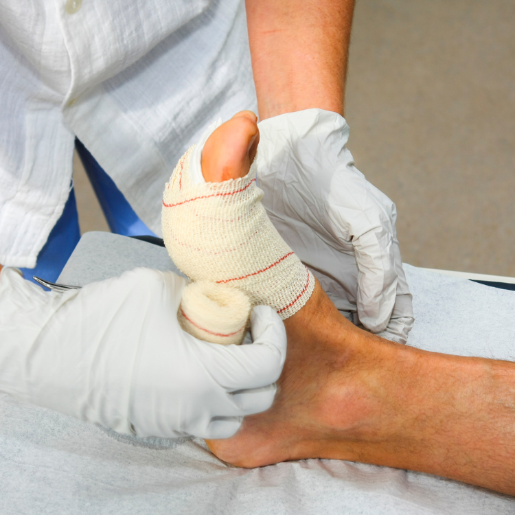 Clinician providing wound care related to pressure injuries