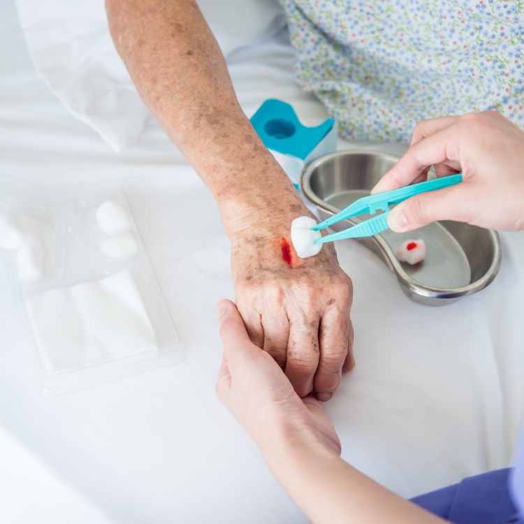 Clinician providing wound care related to traumatic wounds, skin tears & burns